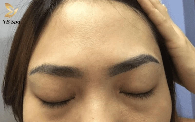 Tình trạng lông mày bất đối xứng không chỉ làm mất đi sự cân đối của ngũ quan mà còn khiến bạn thiếu tự tin khi giao tiếp đối diện.