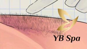 Lông mu cứng là gì? (Nguồn: Internet)