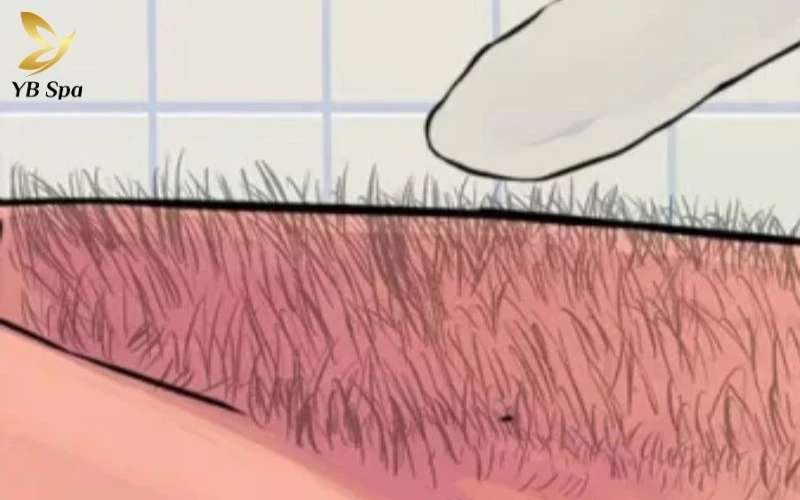 Tướng phụ nữ lông mu rậm theo nhân tướng học và khoa học 11 Sự khác biệt rõ rệt giữa cách nhìn nhận "rậm lông" theo cảm quan dân gian và tiêu chuẩn chẩn đoán trong y khoa