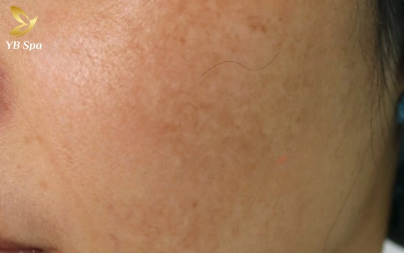 Lông tài là gì? Giải mã từ góc nhìn khoa học và nhân tướng (2026) 19 Lông tài ở má được coi là biểu tượng của người có duyên ăn nói, luôn nhận được sự yêu mến và hỗ trợ từ quý nhân trong xã hội