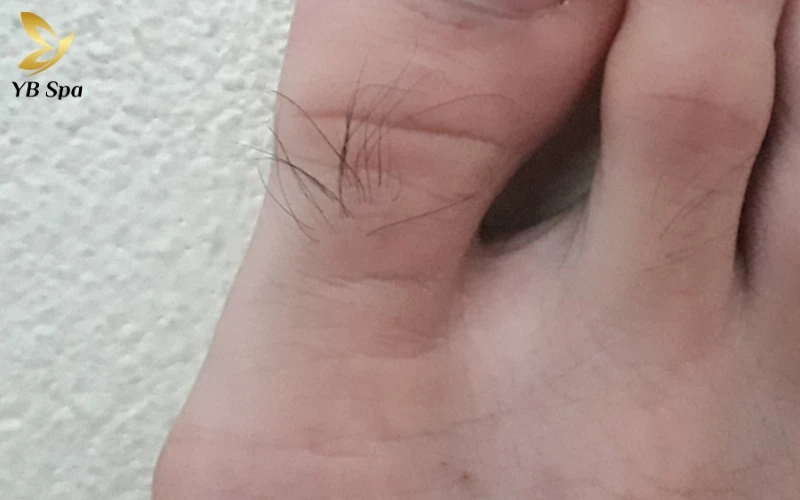 Lông tài là gì? Giải mã từ góc nhìn khoa học và nhân tướng (2026) 21 Sự xuất hiện của sợi lông "lạ" ở đầu ngón chân không chỉ là điềm báo may mắn mà còn phản ánh trạng thái vận hành sinh lý của cơ thể