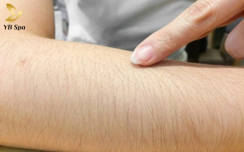 Tướng phụ nữ nhiều lông tay nói lên điều gì? 8 Khám phá ý nghĩa thực sự của tướng phụ nữ nhiều lông tay dưới góc nhìn khoa học và nhân tướng học