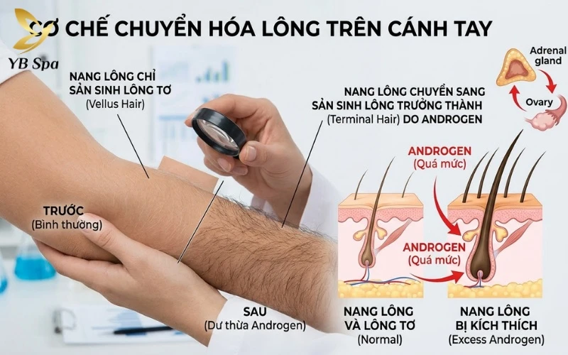 Tướng phụ nữ nhiều lông tay nói lên điều gì? 11 Tình trạng rậm lông tay thực chất là quá trình "nam hóa" cục bộ, khi lông tơ chuyển hóa thành lông trưởng thành do dư thừa nội tiết tố