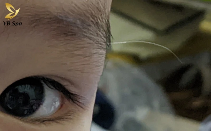 Lông trắng mọc trên mặt là gì? Nguyên nhân và cách xử lý 8 Hiểu rõ nguyên nhân lông trắng mọc trên mặt và quy trình xử lý chuẩn da liễu 2026 để bảo vệ làn da mịn màng, khỏe mạnh