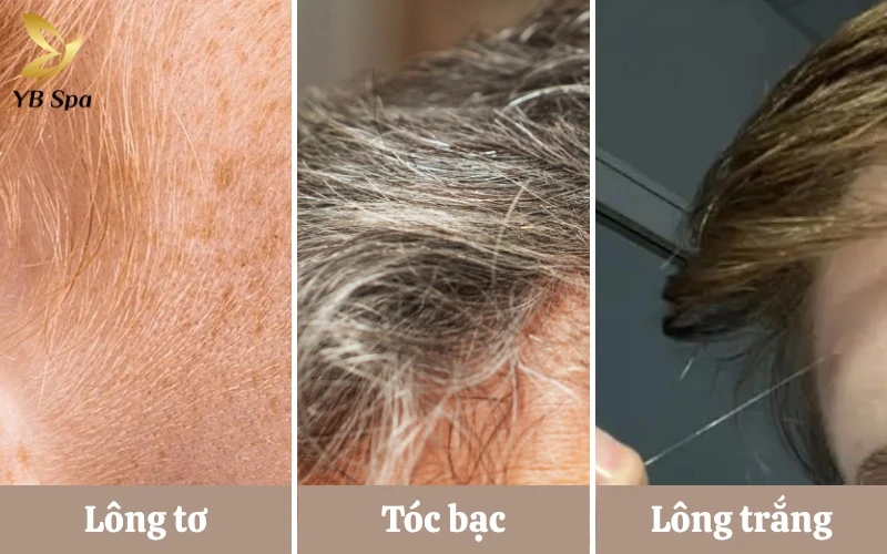 Lông trắng mọc trên mặt là gì? Nguyên nhân và cách xử lý 11 Phân biệt rõ lông tơ, tóc bạc và lông trắng đơn độc giúp bạn lựa chọn phương pháp xử lý da liễu chính xác và hiệu quả nhất