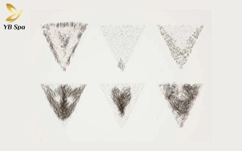 Thẩm mỹ Lông vùng kín hiện đại là sự kết hợp giữa đường nét gọn gàng, mật độ hài hòa và nền da khỏe khoắn từ bên trong