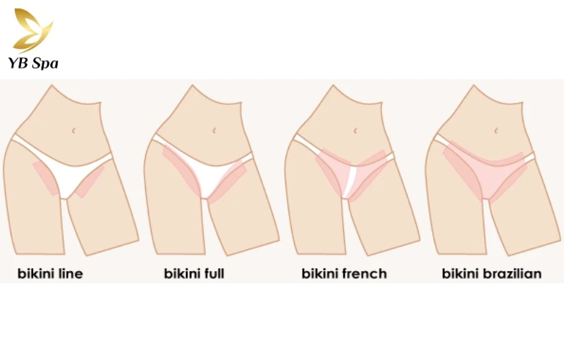 Tỉa theo viền bikini là giải pháp "vàng" cho những ai yêu thích sự gọn gàng nhưng vẫn muốn giữ lại nét đẹp tự nhiên