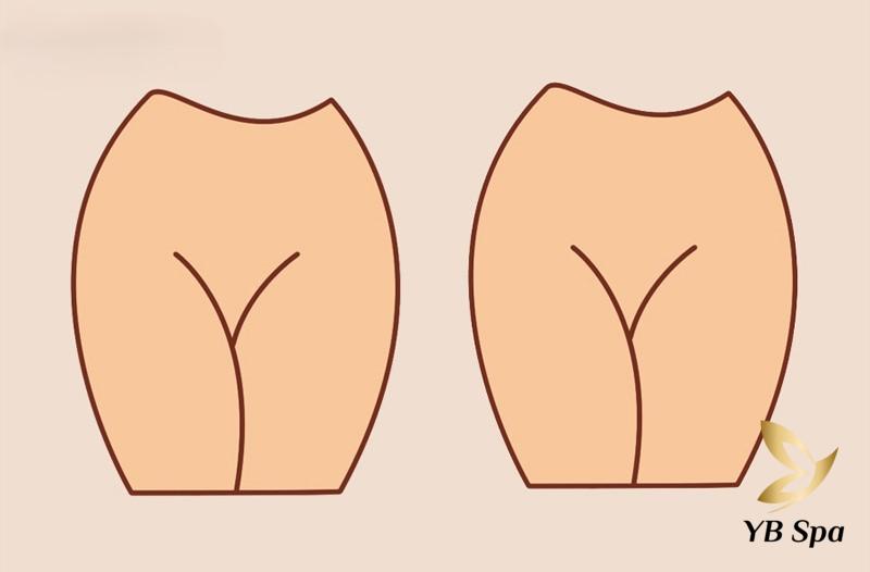 Triệt Lông Bikini Tạo Hình Là Gì? 13 Kiểu Tạo Hình Mới Nhất 31 Lông bikini kiểu Hollywood