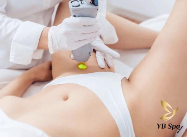 Lưu ý khi triệt lông bikini  (Nguồn: Internet)