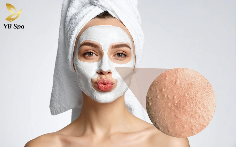 Khám phá ngay Top 7 mặt nạ trị mụn ẩn chuẩn y khoa giúp làm sạch sâu và đẩy nhân mụn hiệu quả