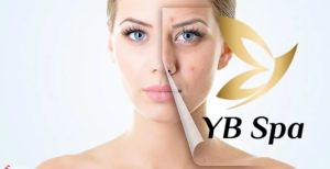 Liệu Trình Meso Trị Mụn: Giải Pháp Hiệu Quả Cho Làn Da Của Bạn