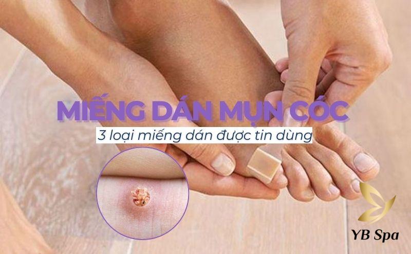 miếng dán mụn cóc