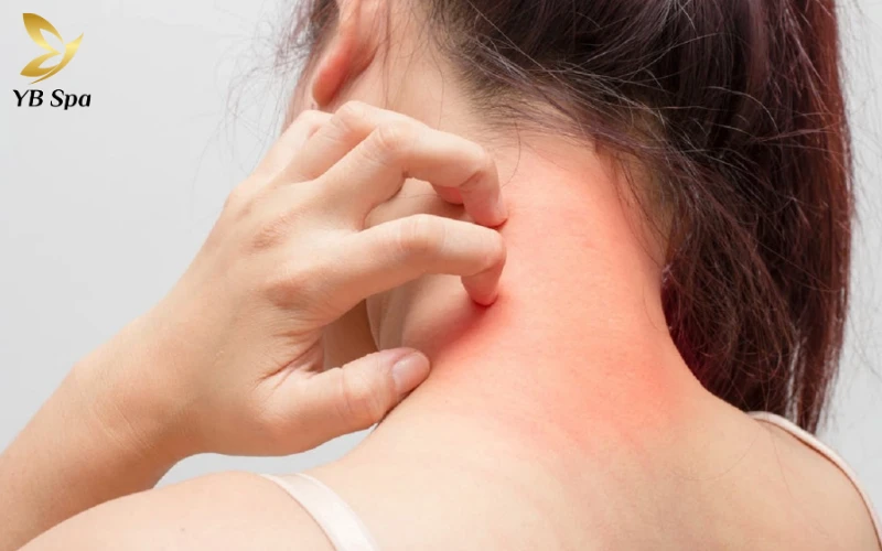 Mọc Mụn Ở Tai Đau Nhức: Nguyên Nhân và Cách Xử Lý 23 Dị ứng thực phẩm gây Mọc Mụn Ở Tai Đau Nhức