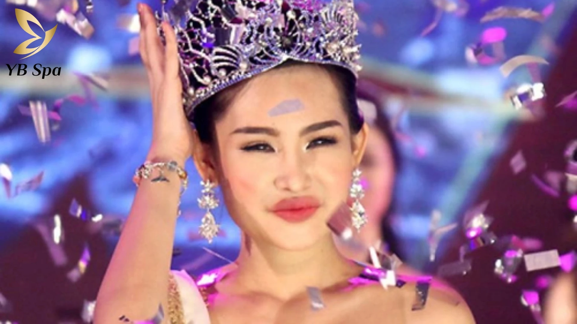 Đặc điểm môi cá trê: môi trên mỏng, môi dưới dày, khóe môi hơi cụp.
