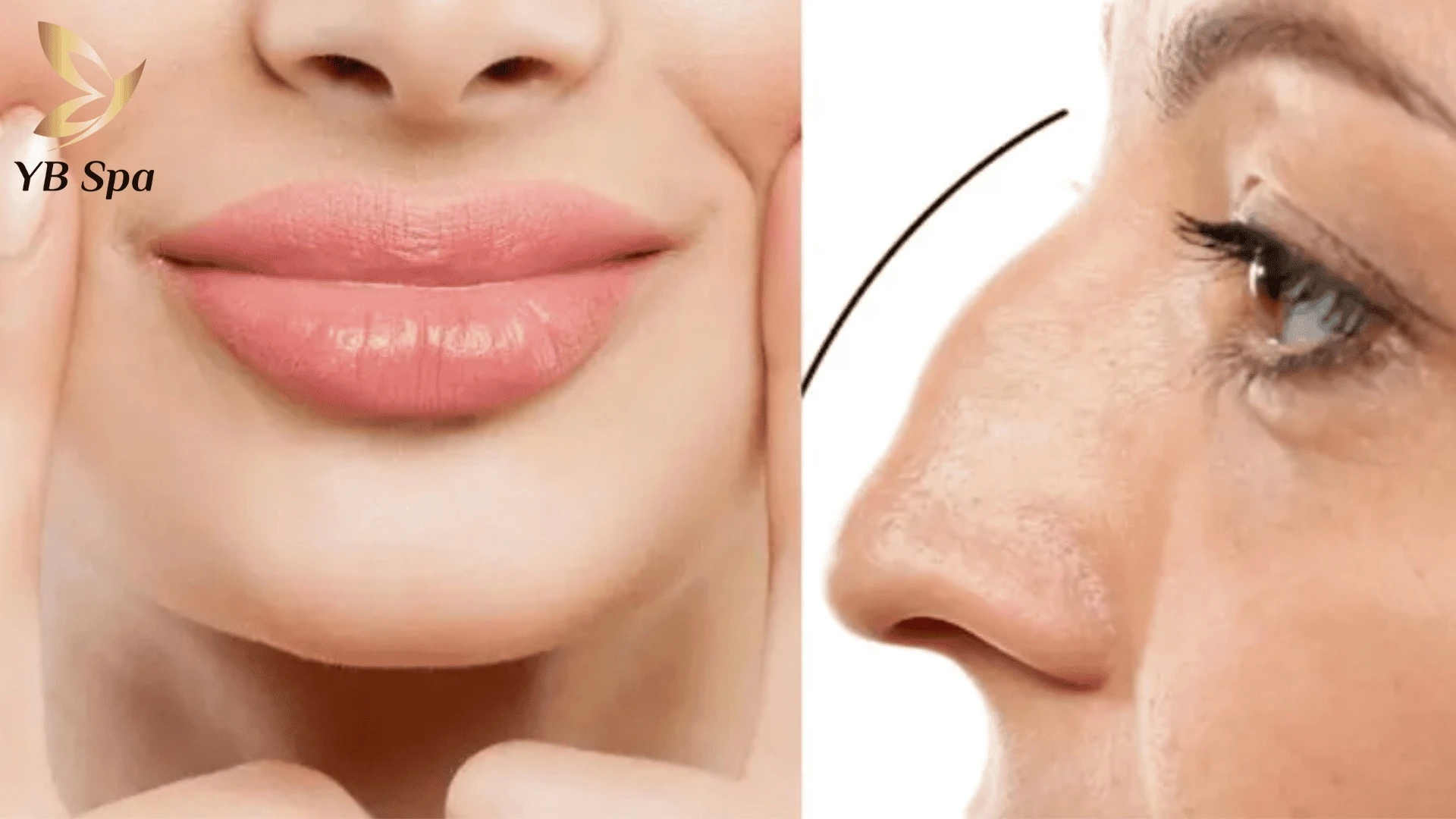 Sự kết hợp giữa môi cá trê và mũi gồ - biểu hiện của tướng số bần hàn trong nhân tướng học.