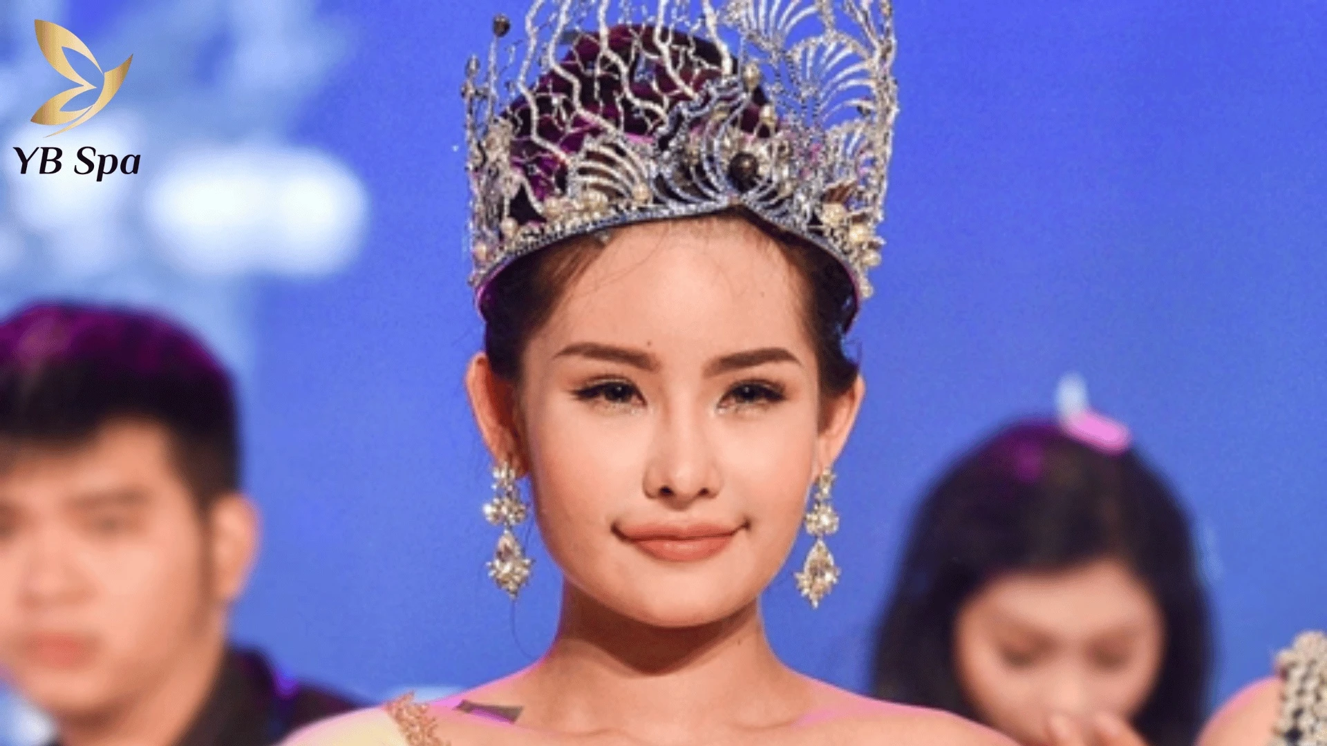 Khi môi cá trê đi cùng ngũ quan hài hòa và ánh mắt tinh anh, những tác động tiêu cực về vận số sẽ được giảm nhẹ đáng kể.