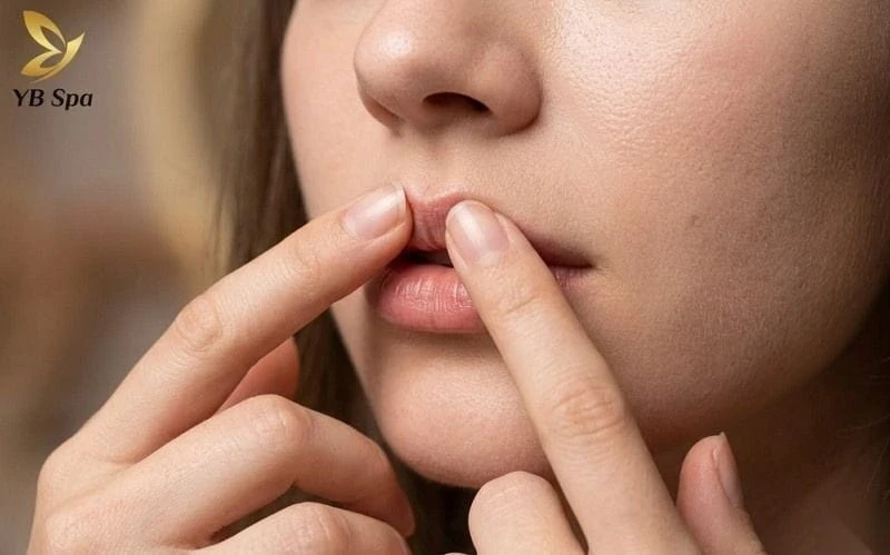 Massage môi nhẹ nhàng có thể hỗ trợ định hình môi chẻ, cần kiên trì.