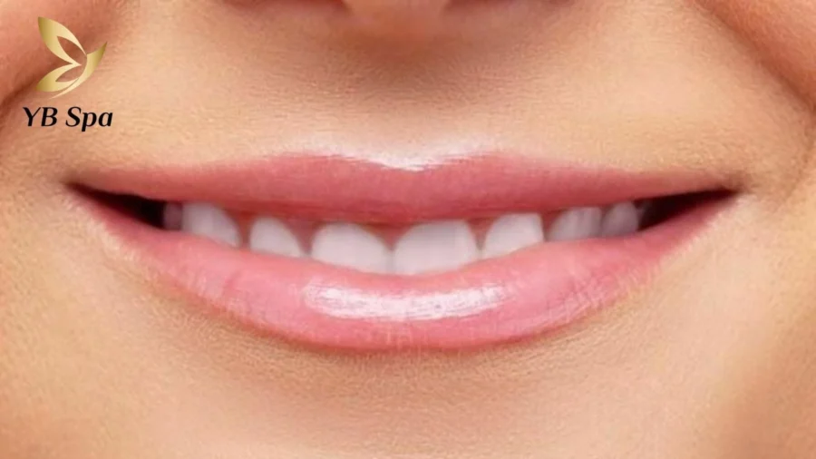  Đôi môi mỏng thiếu độ đầy đặn và đường cong rõ nét, tạo vẻ tinh tế đặc trưng.