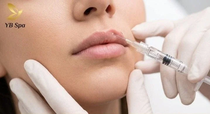 moi mong la gi 7 e1775978144276