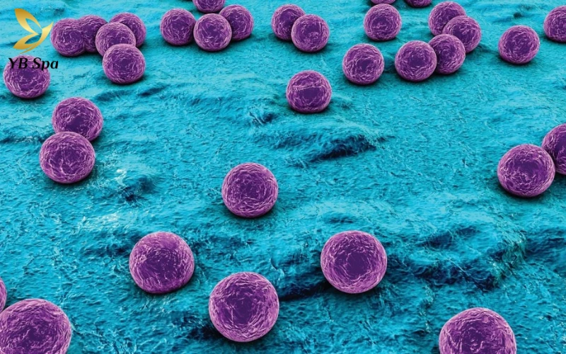 Mụn áp xe có tự khỏi không? Nguyên tắc và biện pháp xử lý an toàn tại nhà 24 Sự tấn công của vi khuẩn Staphylococcus aureus