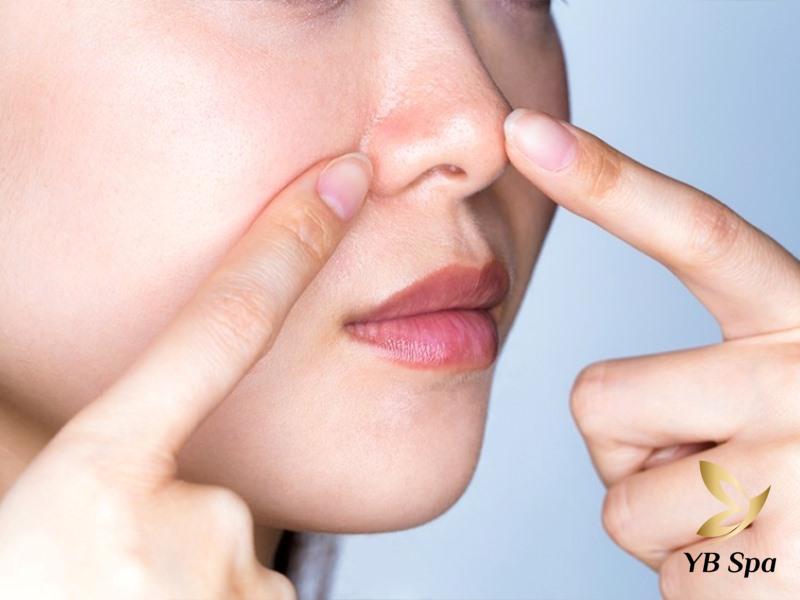 Mụn cám ở mũi là gì? Nguyên nhân, dấu hiệu và cách điều trị