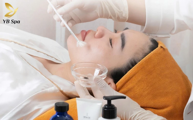 Mụn gạo có nặn được không? Giải đáp chuyên sâu từ chuyên gia 31 Peel da sinh học (Chemical Peel)