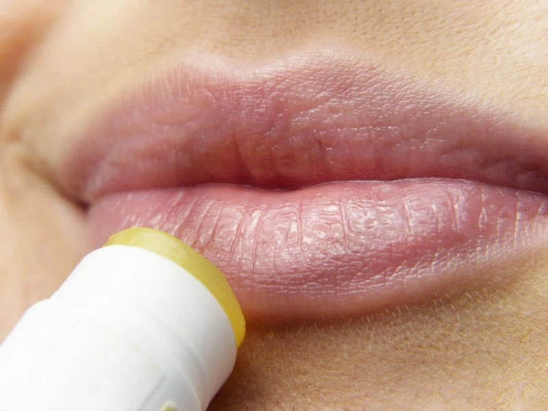 Mụn nước ở môi: Các lưu ý và cách trị môi bị nổi mụn nước 6 Sử dụng kem dưỡng môi