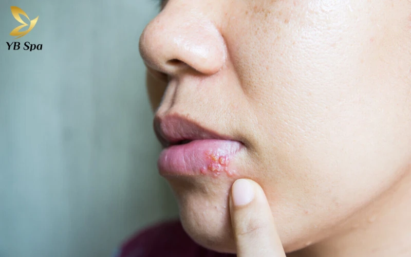 Các biến chứng có thể xảy ra nếu không chăm sóc đúng cách