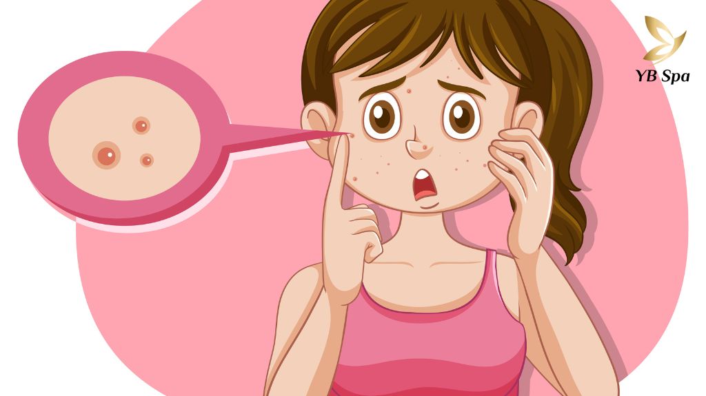 Mun Trung Ca Tuoi Day Thi 1