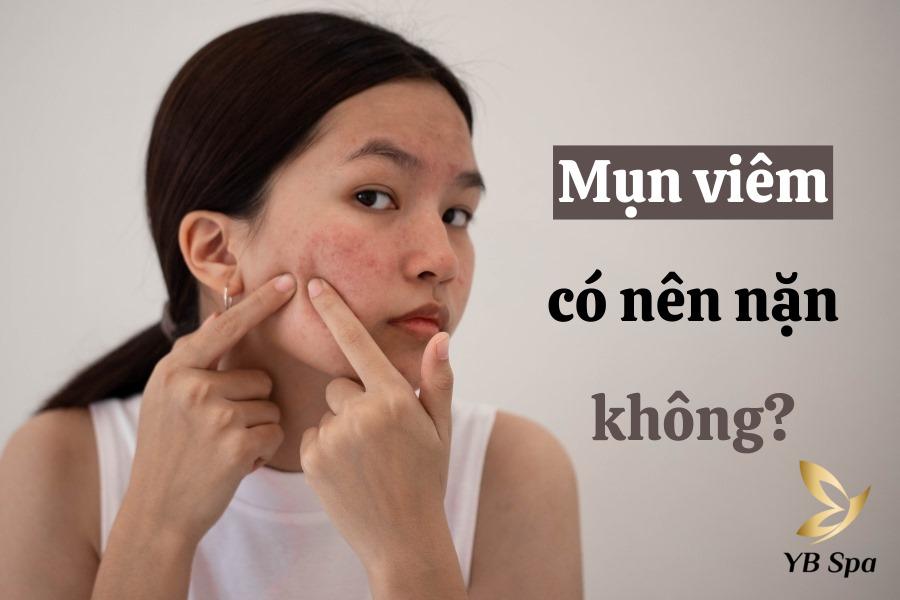 mụn viêm có nên nặn không