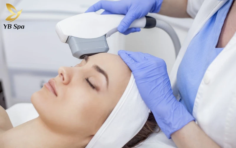 Công nghệ ánh sáng xung cường độ cao (IPL)