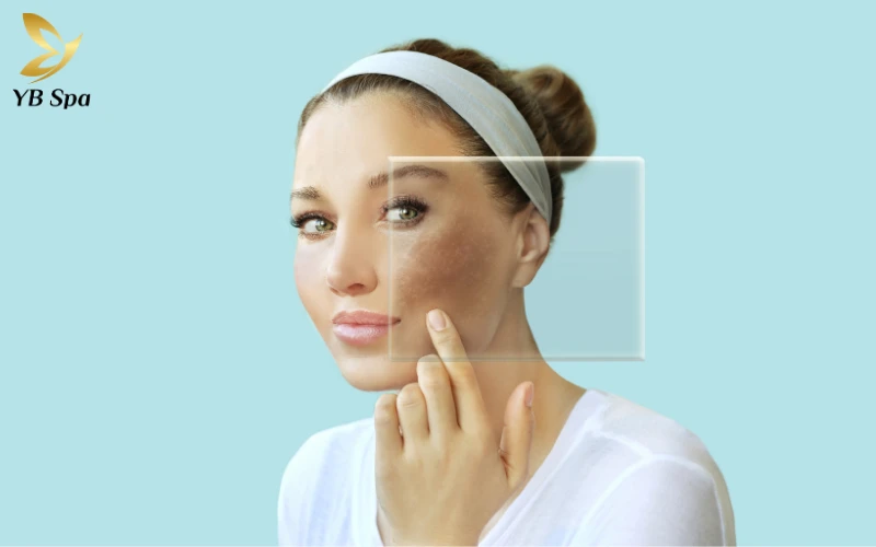 Rối loạn nội tiết tố