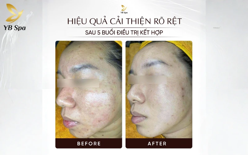 Uy tín thương hiệu và phản hồi từ khách hàng