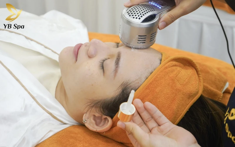 Bắn IPL trẻ hóa làn da