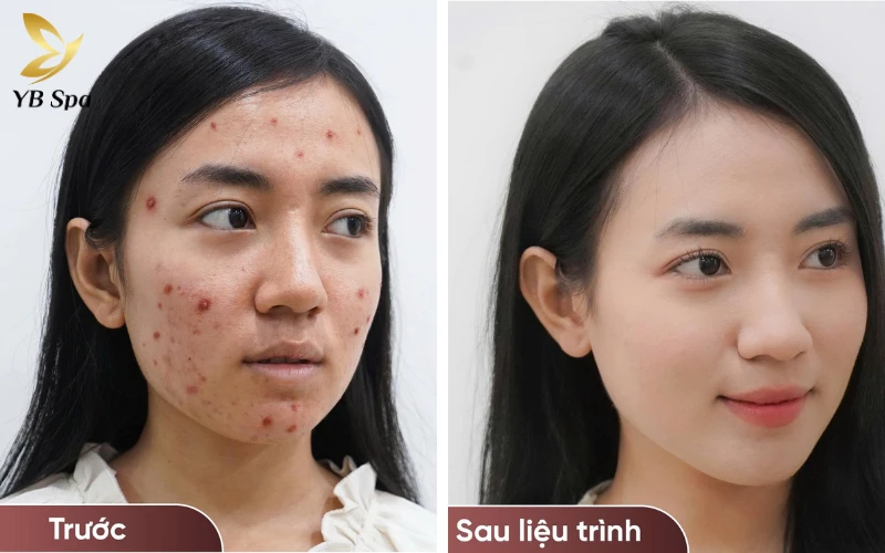 Phản hồi thực tế từ khách hàng đã trải nghiệm dịch vụ tại YB Spa