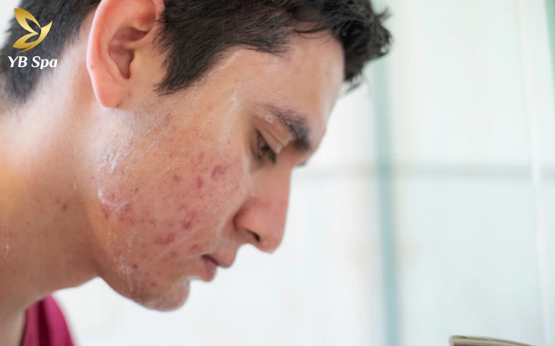 Tình trạng tổn thương bề mặt