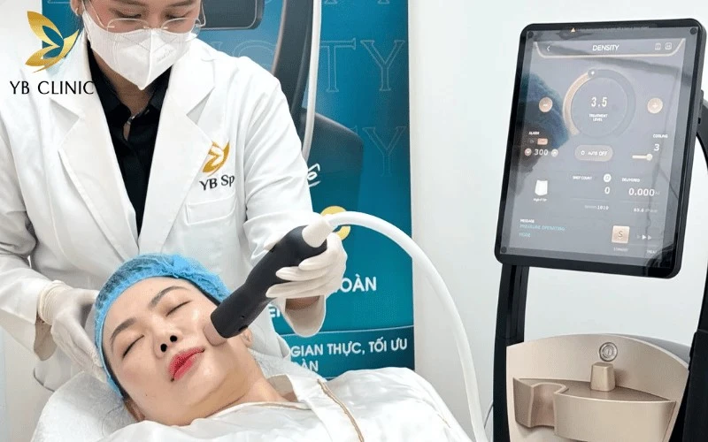Sóng RF tác động sâu vào lớp trung bì, kích thích sản sinh collagen làm đầy nếp nhăn.