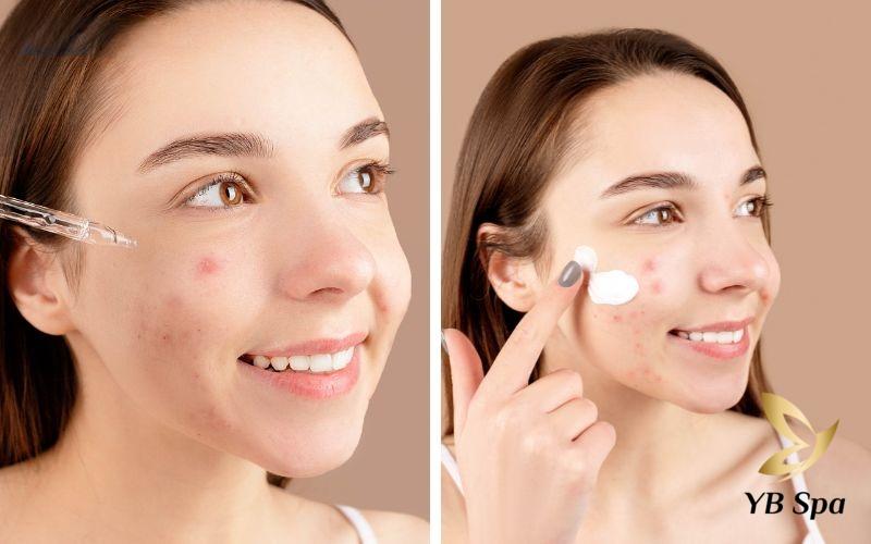 nen boi tri mun truoc hay duong am truoc