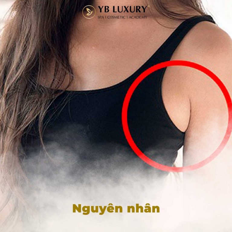 Giảm mỡ nách AN TOÀN bằng công nghệ tân tiến 15 Nguyen Nhan Hinh Thanh Mo Vung Nach 768x768
