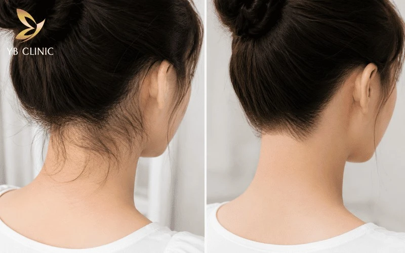6 Chi Tiết Nhỏ Quyết Định Thần Thái Khi Búi Tóc 10 Đường chân tóc gáy gọn gàng giúp tạo góc nghiêng thanh thoát, tăng vẻ chỉn chu và tinh tế cho kiểu búi tóc.