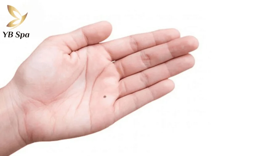 Nốt ruồi ở gò Thái Dương biểu thị năng khiếu nghệ thuật, sự nổi tiếng và danh vọng trong cuộc sống.