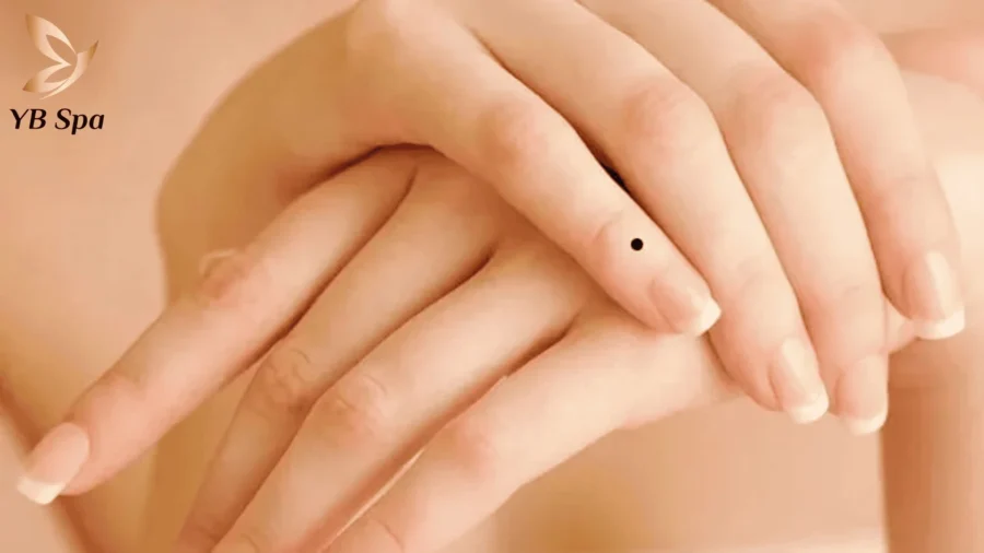 Nốt ruồi trên ngón tay ẩn chứa nhiều thông điệp thú vị về vận mệnh và tính cách cá nhân.