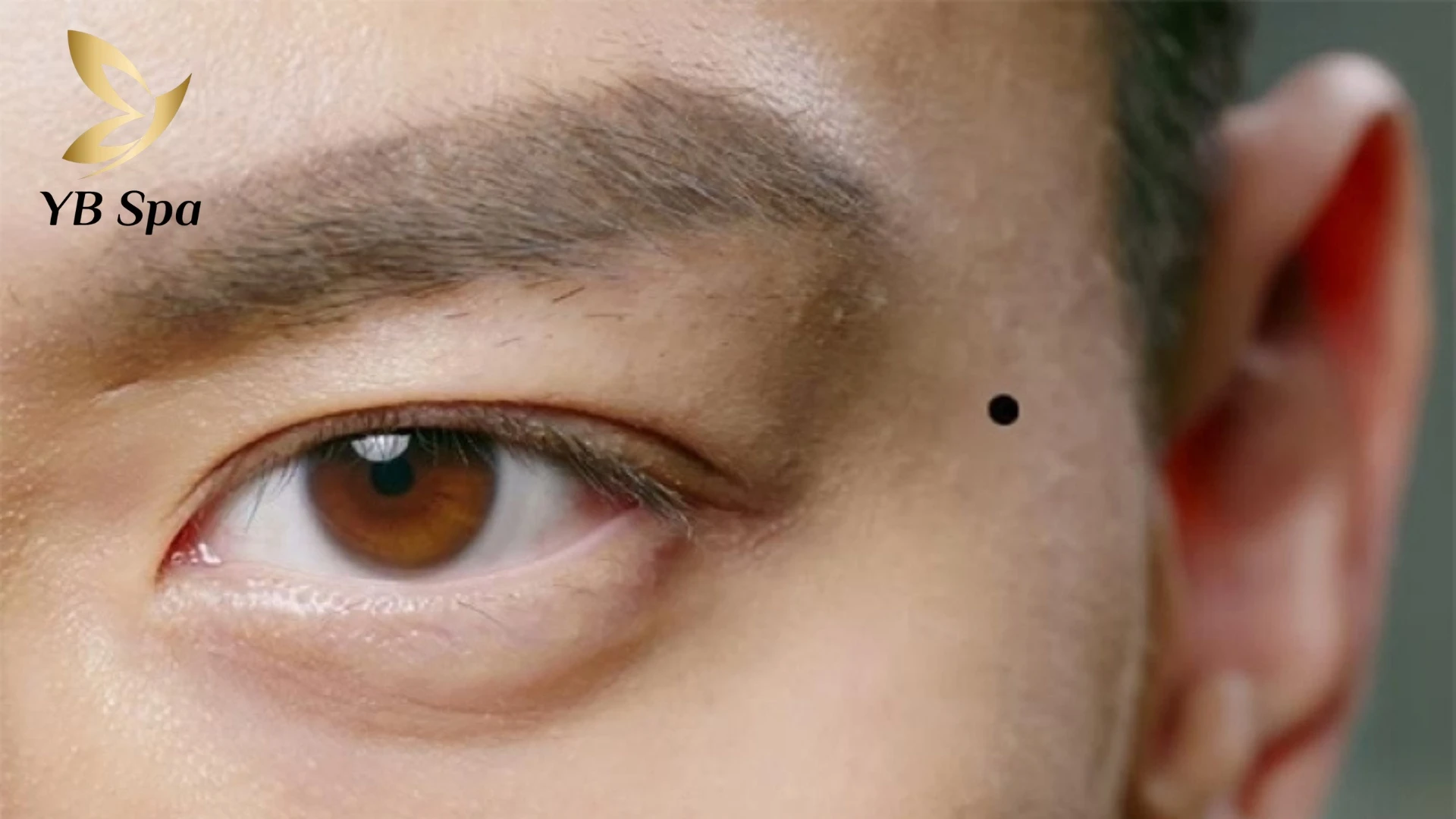 Đàn ông sở hữu nốt ruồi ở thái dương bên trái là thường gặp nhiều khó khăn