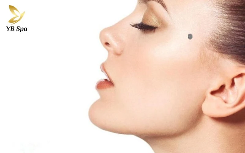 Nốt ruồi ở thái dương đa phần là TỐT