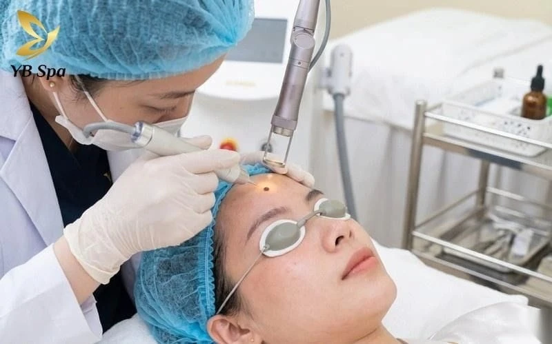Ý Nghĩa Nốt Ruồi Ở Trán Theo Từng Vị Trí Và Lưu Ý Khi Tẩy 18 not ruoi o tran 8