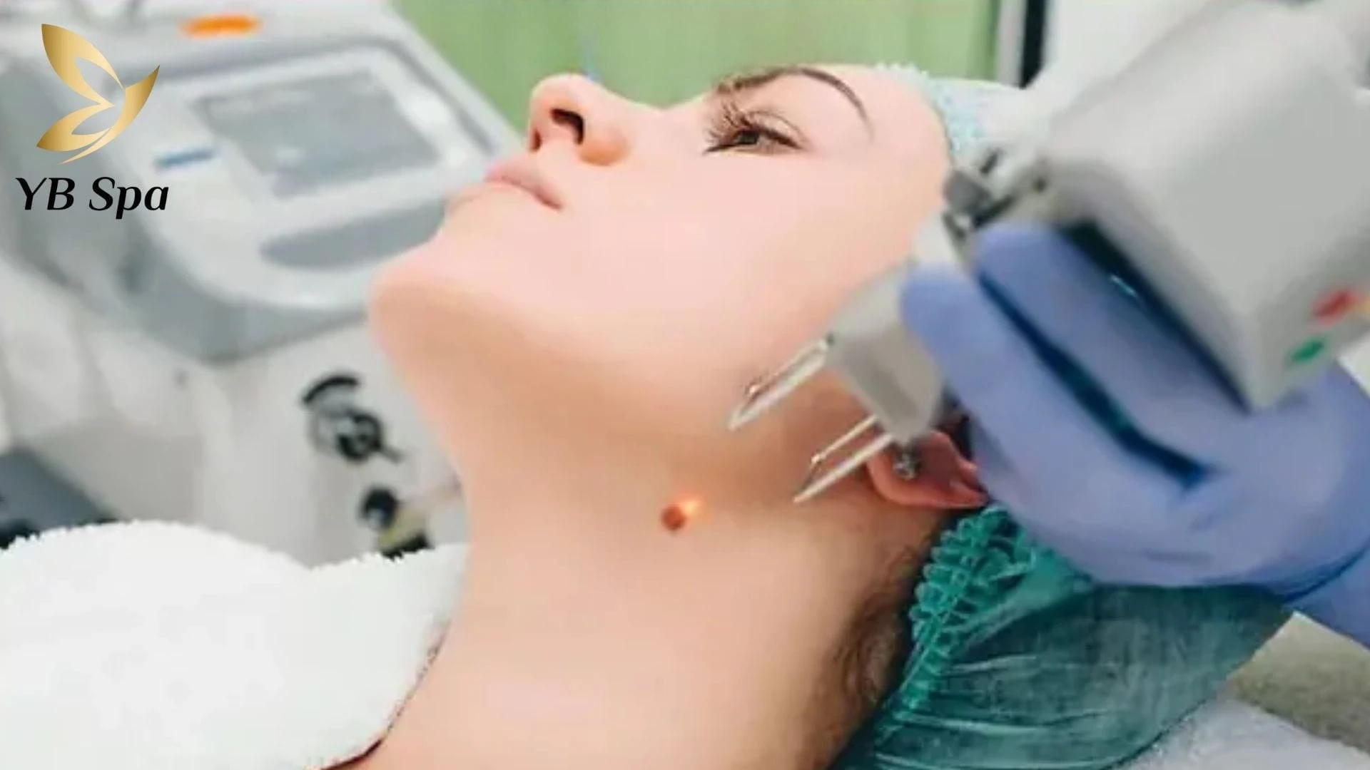 Ý Nghĩa Nốt Ruồi Ở Trán Theo Từng Vị Trí Và Lưu Ý Khi Tẩy 19 not ruoi o tran 9