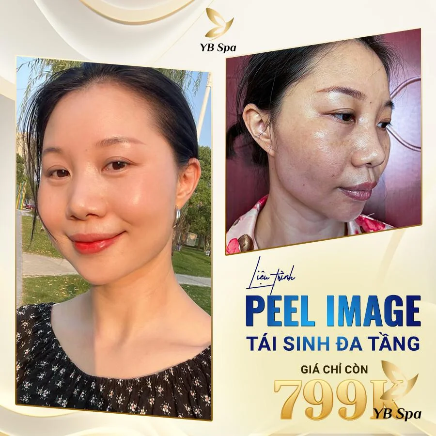 Peel da mặt: Bí quyết cho làn da đẹp không tì vết 21 peel-da-mat-tai-spa