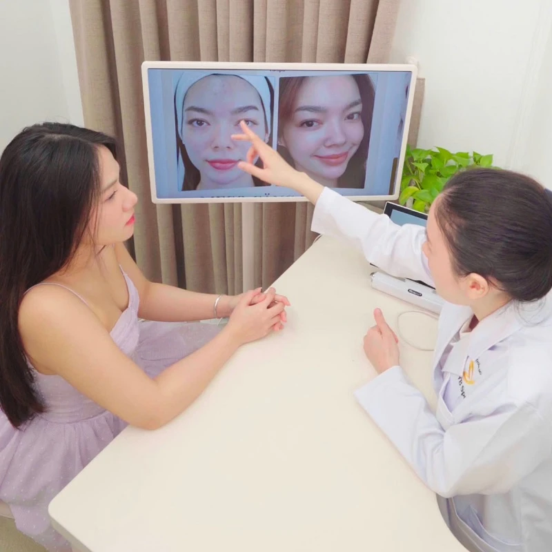 Peel Da tại YB Spa