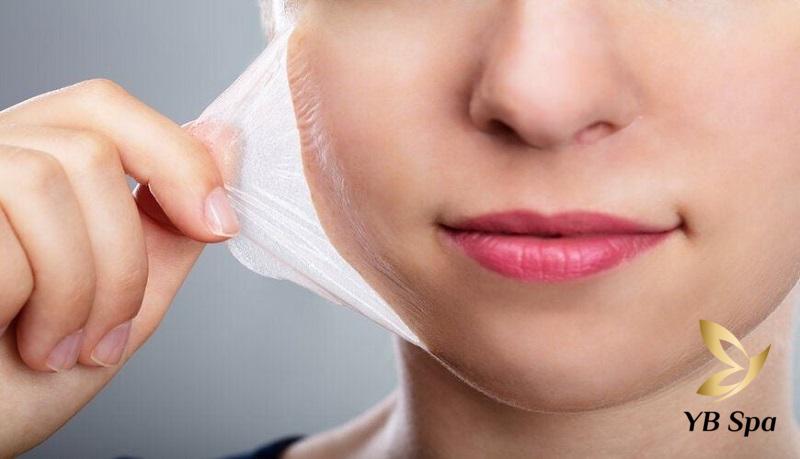 Peel da có đẩy mụn không? Nguyên nhân và cách xử lý 21 peel da trị mụn mang lại nhiều lợi ích khi được thực hiện đúng cách