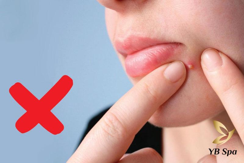 Peel da có đẩy mụn không? Nguyên nhân và cách xử lý 23 Peel da có đẩy mụn không? Nguyên nhân và cách xử lý